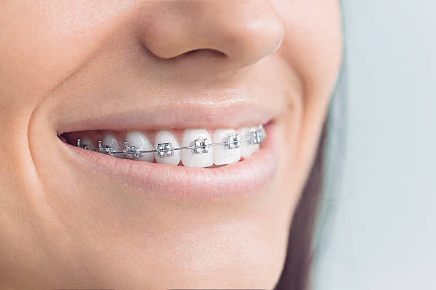 Dental Bonding in Williamston, MI